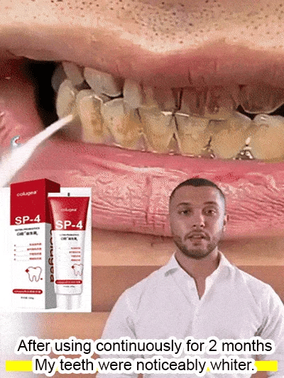 Sp-4 Ultra Whitening Toothpaste,