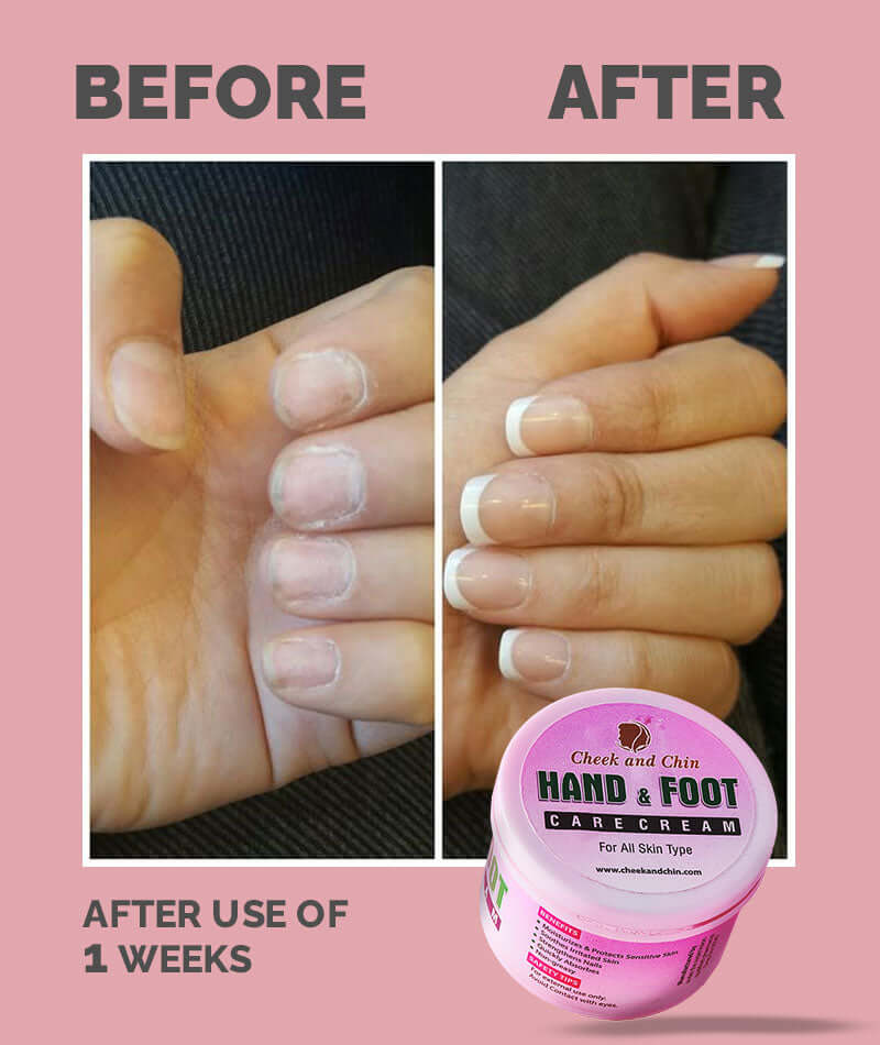 Hand and foot Care cream