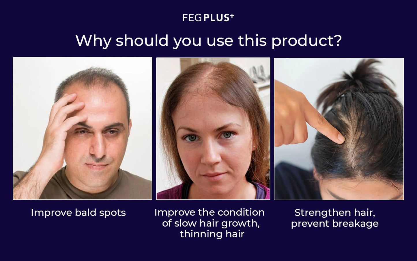 FEG PLUS HAIR GROWTH SPRAY
